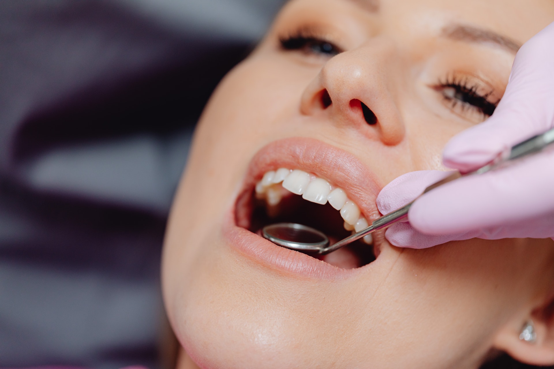 Read more about the article Dlaczego warto dbać o zęby